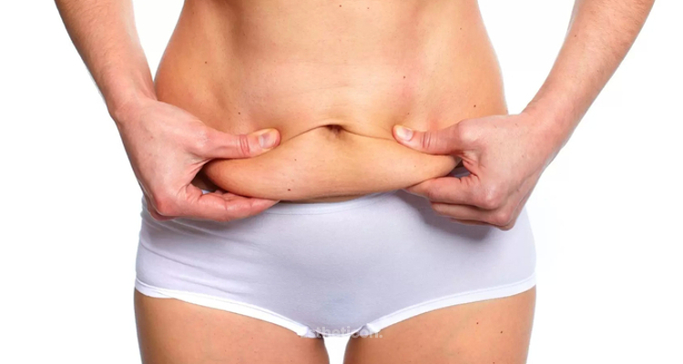 Mommy makeover – cesta k telu ako pred pôrodom