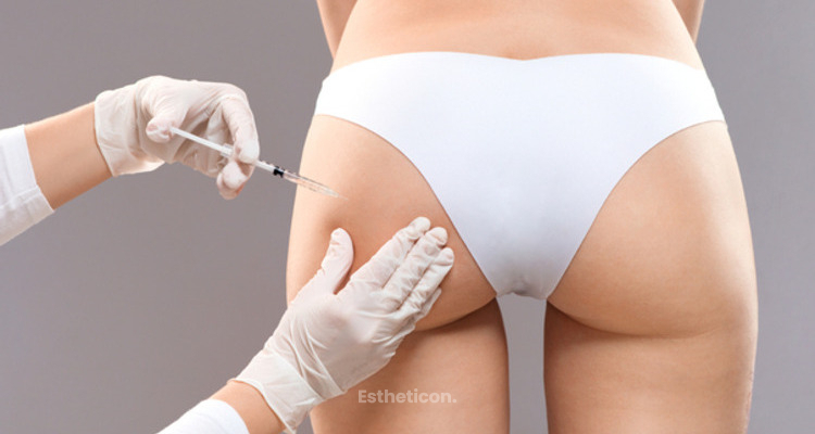 Mýty a fakty o injekčnej lipolýze