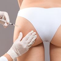 Mýty a fakty o injekčnej lipolýze