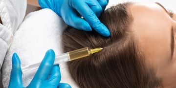 Dokáže plazma terapia účinne pomôcť pri vypadávaní vlasov?