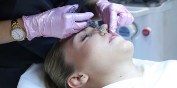 Kontúrová plastika: Všetko, čo potrebujete vedieť o výplniach kyselinou hyalurónovou