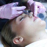Kontúrová plastika: Všetko, čo potrebujete vedieť o výplniach kyselinou hyalurónovou