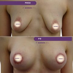 Avelane Clinic