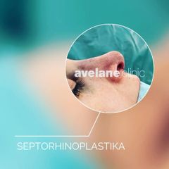 septorhinoplastika primar Mladek 2