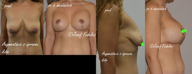 z predu uncen