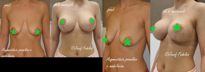 Augmentácia s modeláciou