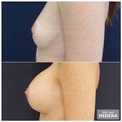 mudr. jozef hedera_augmentacia_concept clinic_4 (1)
