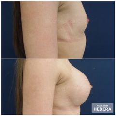 mudr. jozef hedera_augmentacia_concept clinic_1