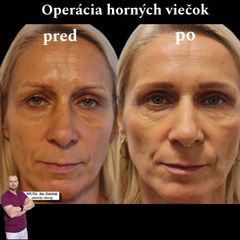 Horne viecka MUDr. Ján Zeleňák