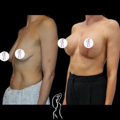 Augmentácia s modeláciou