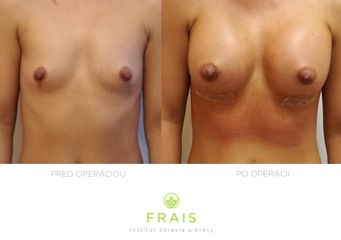 PRED PO PRSIA spredu 24.4