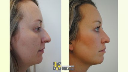 Pacient nos - ORL KLINIKA, s.r.o.