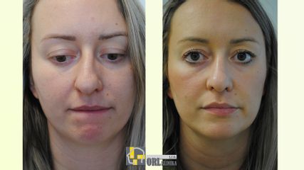 Pacient nos - ORL KLINIKA, s.r.o.