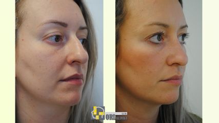 Pacient nos - ORL KLINIKA, s.r.o.