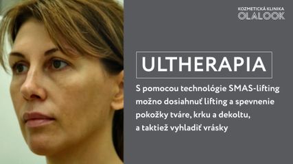 ulthera1 1