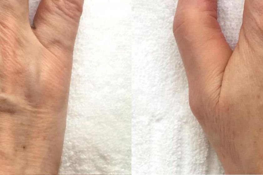 Anti aging pred a po - 807169