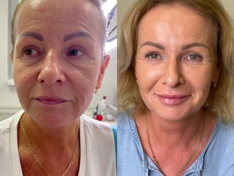 Anti aging pred a po - 860543