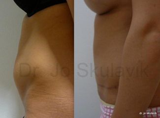 Bettina14