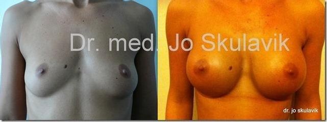 linda New fantastic breast