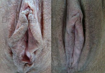 labien2