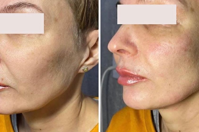 Anti aging pred a po - 853289