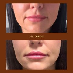 Podvihnutie kútikom úst