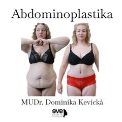Abdominoplastika - MUDr. Dominika Kevická