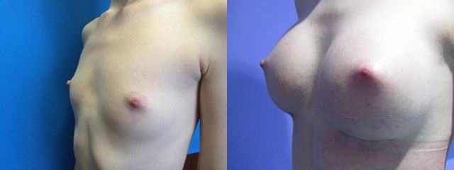 3 1