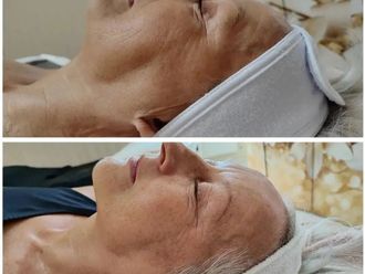 Anti aging - 845104