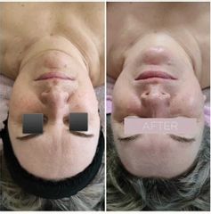 Anti Aging - Dream Beauty