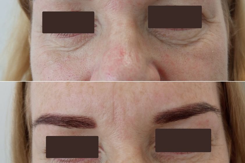 Anti aging pred a po - 879855