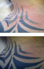 tetovanie po