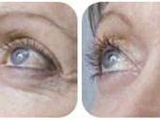 Mezoterapia - 803924