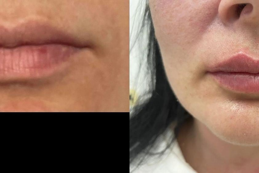 Anti aging pred a po - 807582