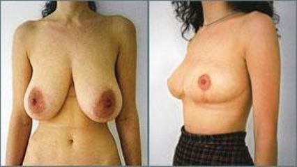 zmenseni3