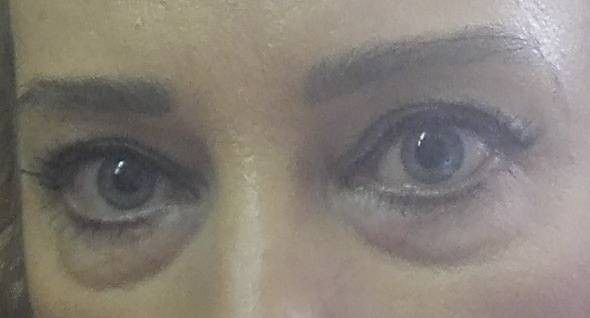 126123