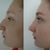 Operácia nosa - Dr. Skulavik, profesionál s ľudským prístupom