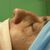 Rhinoplastika - MUDr. Kočajda