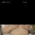 Abdominoplastika bratislava mudr.racz
