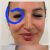 Nitovy lifting a botulotoxin