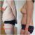 Abdominoplastika (s rafiou diastázy a pruh) a mastopexia
