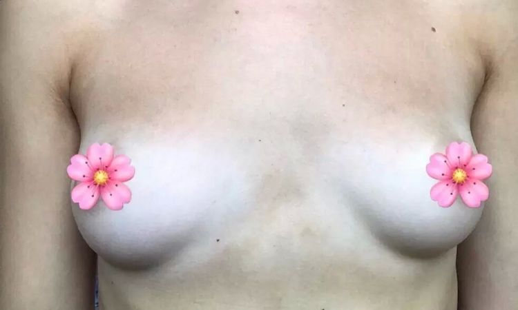 126444