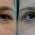 Blefaroplastika, MUDr. Škulavíková