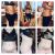 Foto pred a mesiac po abdominoplastike