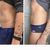 CoolSculpting spodného brucha