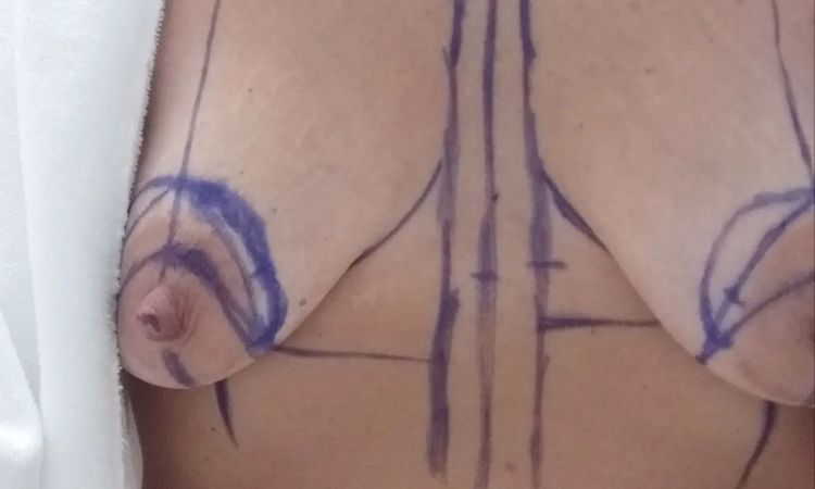 30418