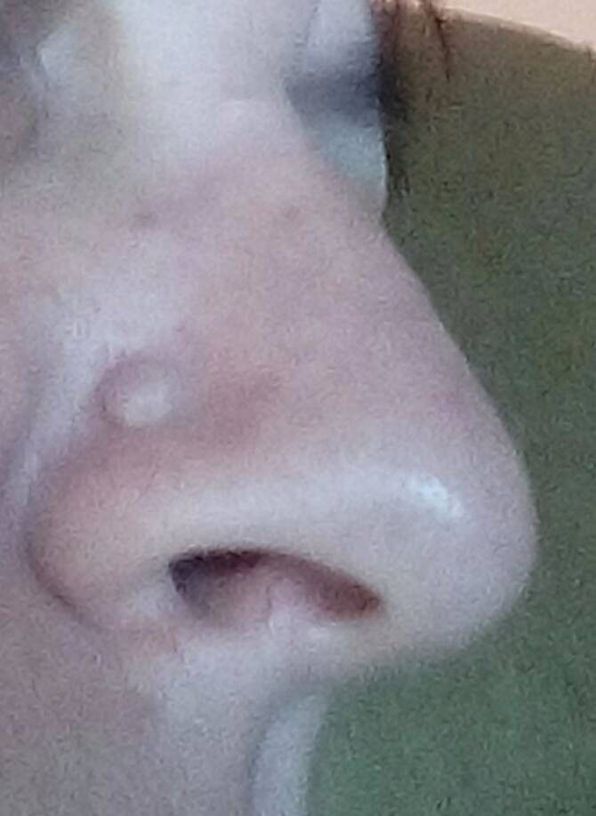 30044