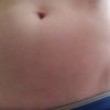 liposukcia brucho aj pas