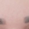 Laserové odstránenie permanentného make-upu-microblading-obočie-koľko ošetrení je potrebné absolvovať