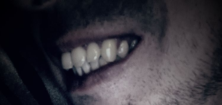 Existuje zákrok,ktory by dokazal upraviť okolie úst?